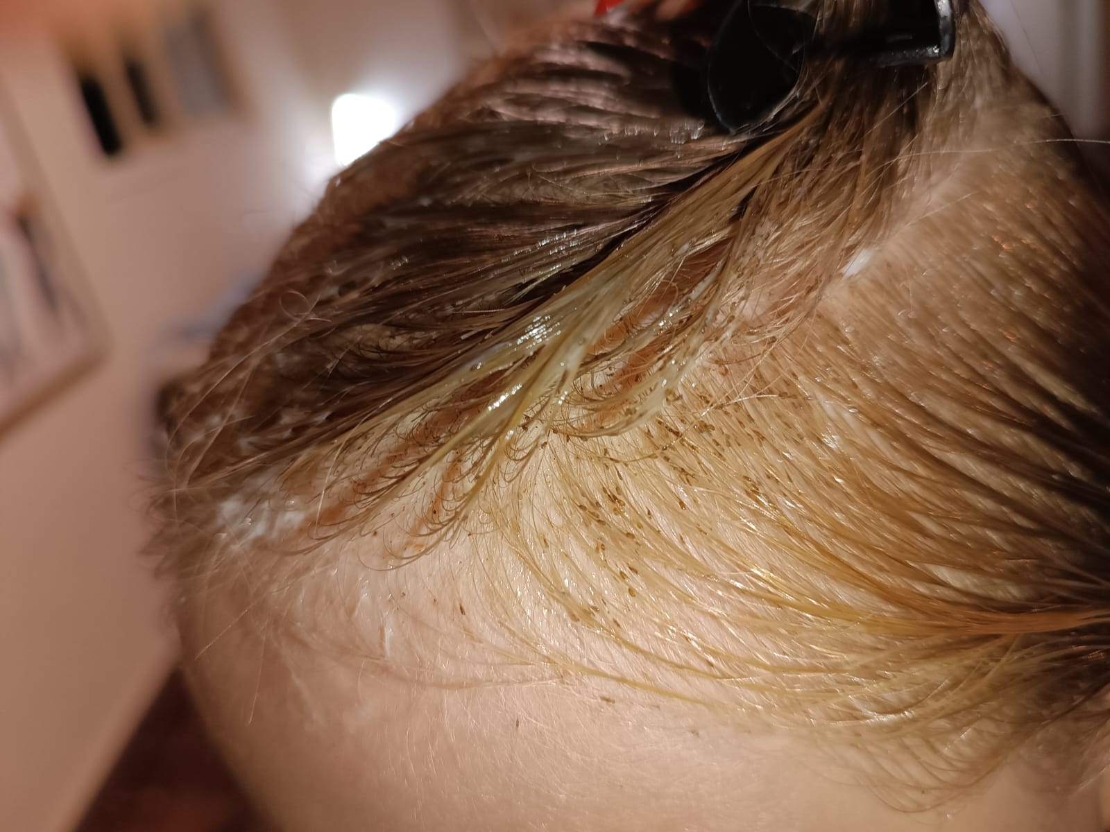 מנפט ועד הייטק: ההיסטוריה של טיפולי הכינים